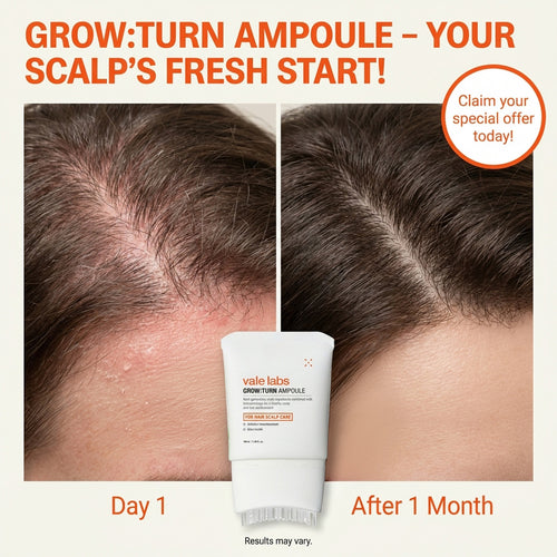 Vale labs —  Hair Growth Protocol. Low Ferritin