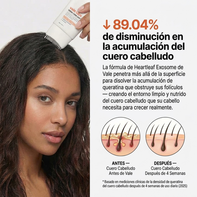 Vale Hair Growth - Protocolo para  el Crecimiento Cabello