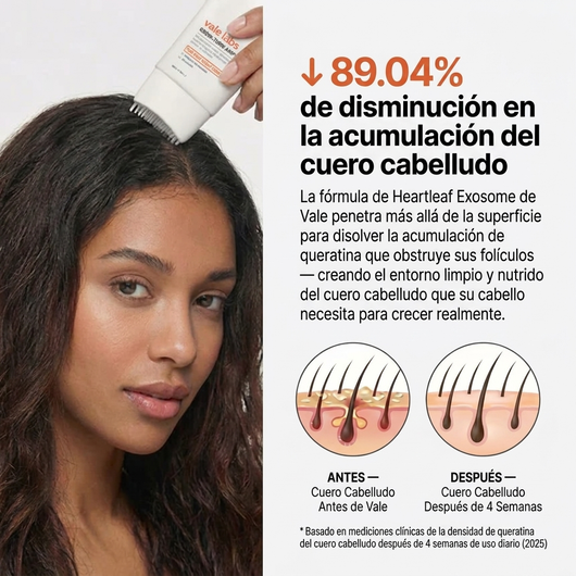 Vale Hair Growth - Protocolo para  el Crecimiento Cabello