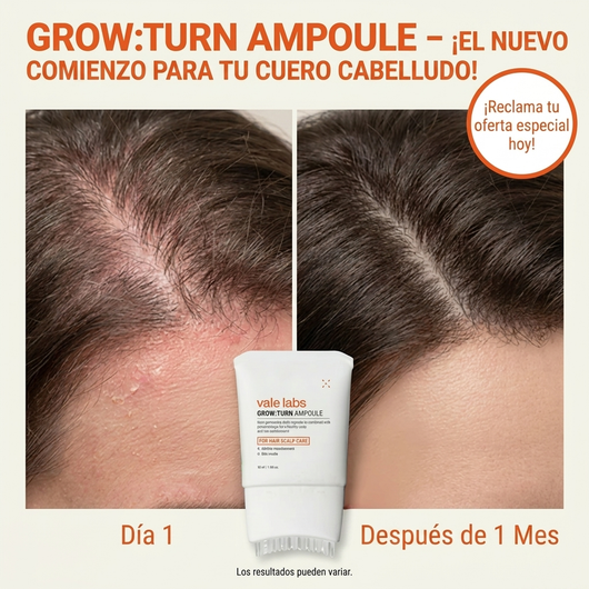 Vale Hair Growth - Protocolo para  el Crecimiento Cabello