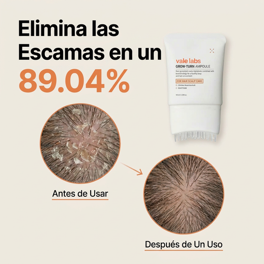 Vale Hair Growth - Protocolo para  el Crecimiento Cabello