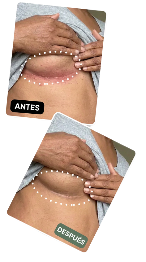 Antes y después